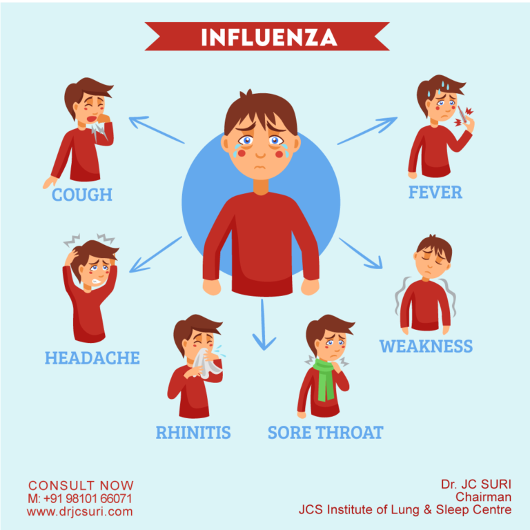 influenza a